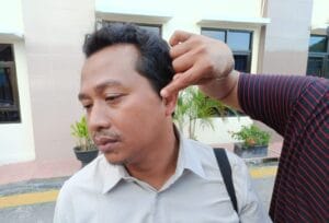 Jurnalis Balikpapan Pos, Moeso, menunjukkan area pipinya yang lebam karena dipukul saat meliput kasus pencabulan di PN Balikpapan, Rabu (19/3/2025). (Foto: AJI Balikpapan)